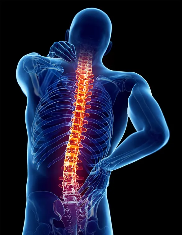 Georgia Spinal Epidural Abscess Claims | Harris Lowry Manton