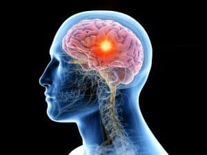 Researchers Find a Link Between Head Injuries and Brain Tumors