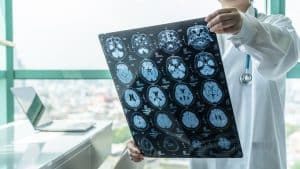 Traumatic Brain Injury Is a Chronic Health Condition