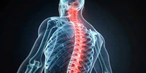 SCI Rehab in Georgia
