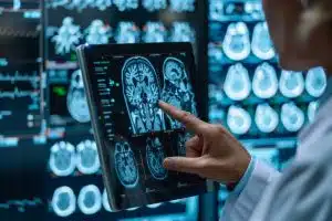 How Medical Experts Strengthen Brain Injury Cases in Georgia Lawsuits